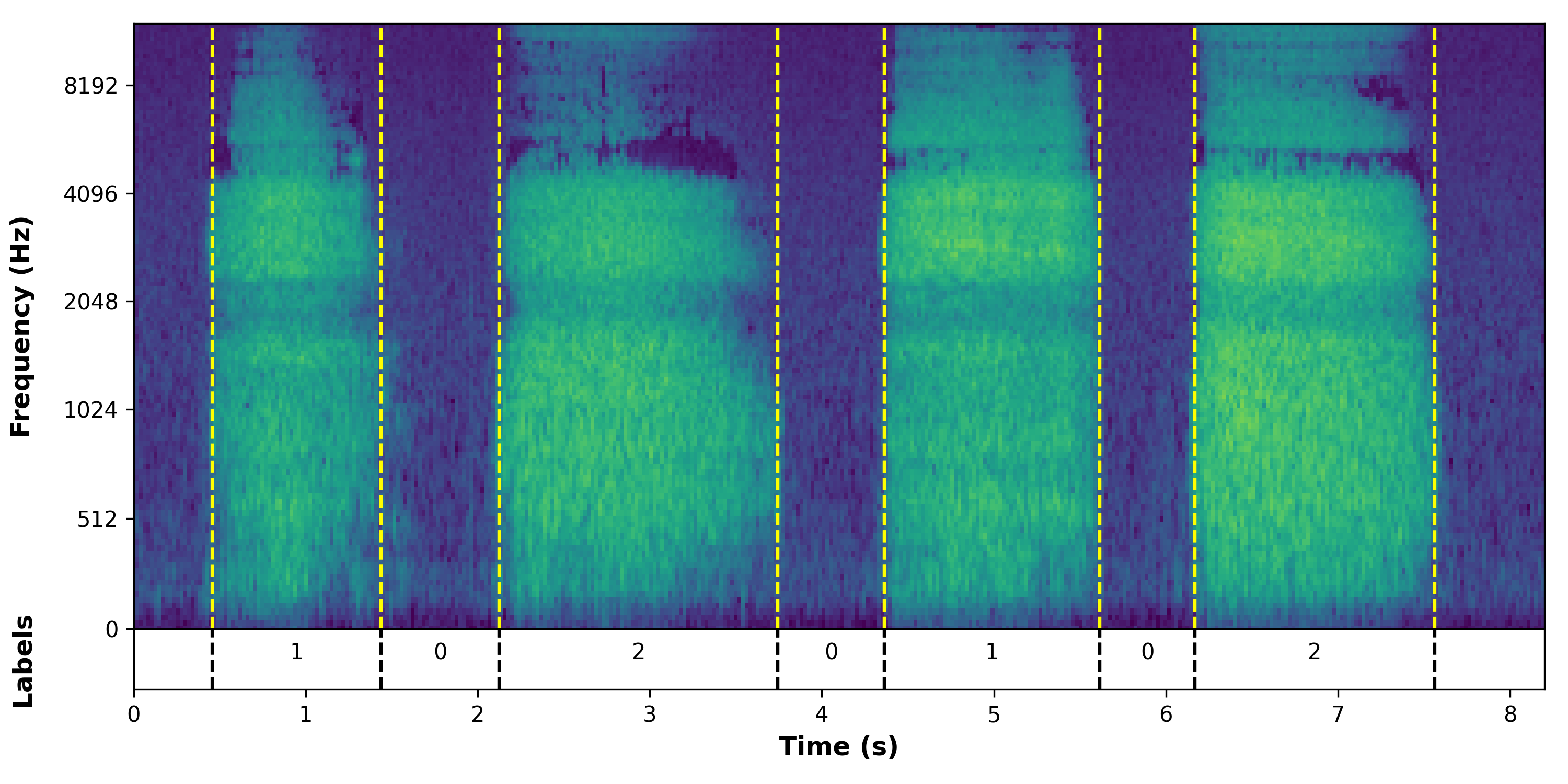 Audio Spectrogram for Nasal Breathing.