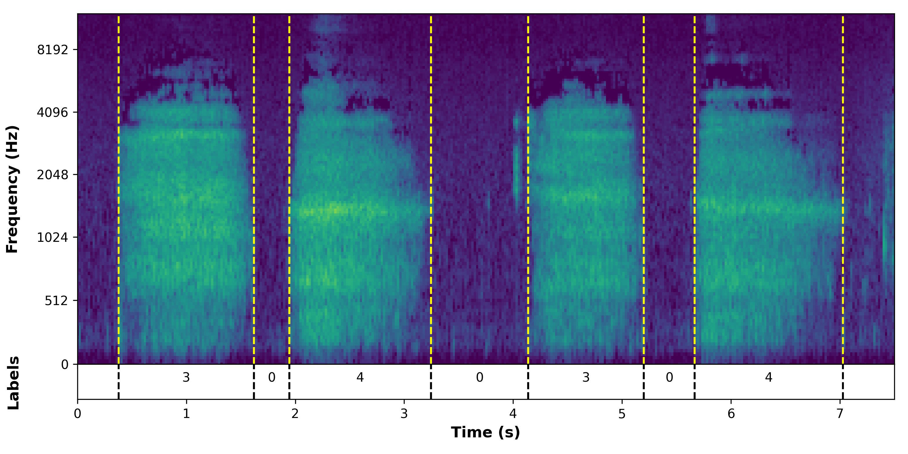 Audio Spectrogram for Oral Breathing.