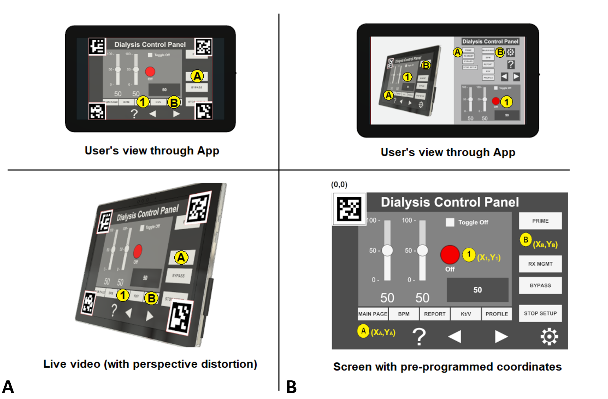 Four-marker and single-marker approach for tracking.